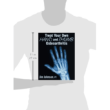 Treat Your Own Hand and Thumb Oteoarthritis – Book size